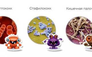 Инфекционный полиартрит: симптомы, методы диагностики и лечения