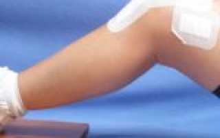 ZB Pain Relief ортопедический пластырь — отрицательные отзывы, очередной развод?
